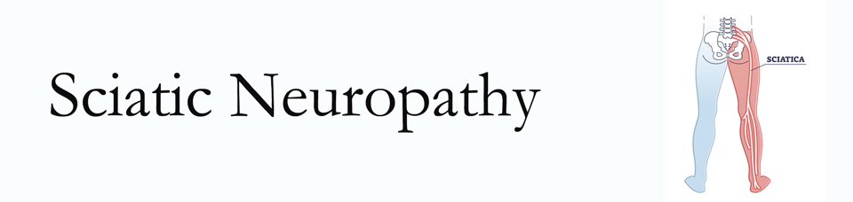 Montreal neuropathy pain (sciatica) 