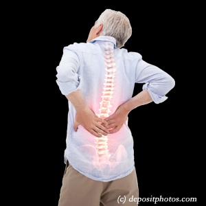 image Montreal back pain with lumbar spinal stenosis
